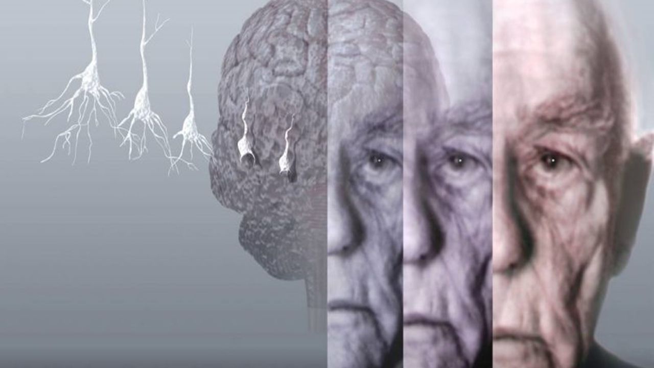 Demans uyarısı: Hafıza ve düşünce düşüşüyle ​​bağlantılı 'yaygın olarak reçete edilen ilaç