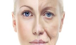 Kadın cildinin gençleşmesi yaşlanma hastalıklarının üstesinden gelebilir